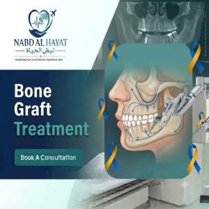 Bone Graft Treatment