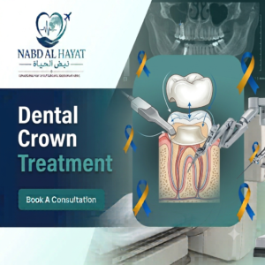 Dental Crown Treatment